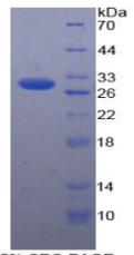 SDS-PAGE (ICOSLG-7689H).jpg